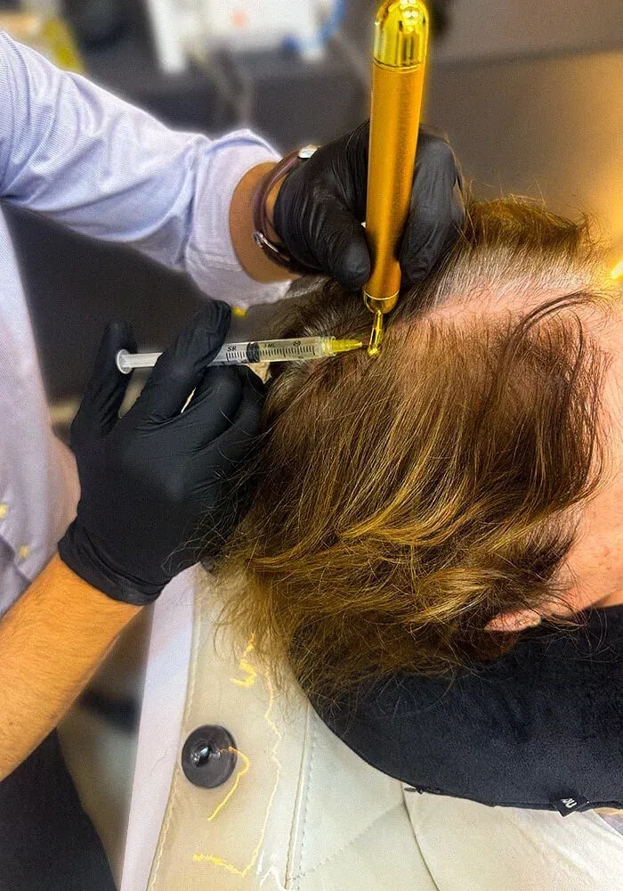 Protocolo clínico para queda de cabelo no Instituto Venanzi, Campo Mourão