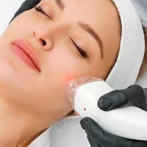 Laser-Lavieen-duepele