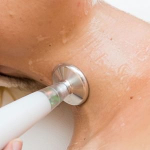 aparelho-de-jato-de-plasma-jett-plasma-lift-celebrim-6 (1)